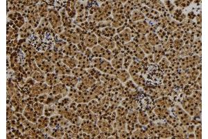 ABIN6279445 at 1/100 staining Mouse kidney tissue by IHC-P. (QSER1 antibody  (Internal Region))