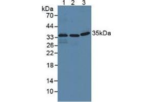 Figure. (IFI35 antibody  (AA 2-286))