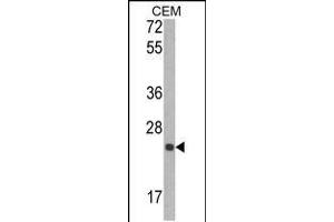 Western blot analysis of TIMP1 Antibody in CEM cell line lysates (35ug/lane) (TIMP1 antibody  (N-Term))
