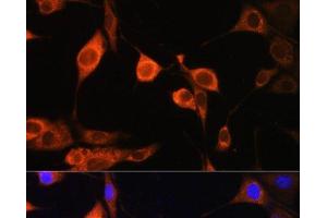 Immunofluorescence analysis of NIH/3T3 cells using ATP5D Polyclonal Antibody at dilution of 1:100. (ATP5F1D antibody)