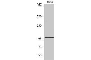 Western Blotting (WB) image for anti-Megakaryoblastic Leukemia (Translocation) 1 (MKL1) (N-Term) antibody (ABIN3185691) (MKL1 antibody  (N-Term))