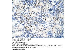 Rabbit Anti-TROVE2 Antibody  Paraffin Embedded Tissue: Human Kidney Cellular Data: Epithelial cells of renal tubule Antibody Concentration: 4. (TROVE2 antibody  (N-Term))