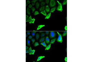 Immunofluorescence analysis of A549 cell using HSP90AA1 antibody. (HSP90AA1 antibody  (AA 433-732))