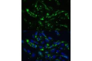 Immunofluorescence analysis of U2OS cells using CGRP antibody (ABIN6128310, ABIN6137852, ABIN6137855 and ABIN6221187) at dilution of 1:100. (CGRP antibody  (AA 1-141))