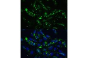 Immunofluorescence analysis of U2OS cells using CGRP antibody (ABIN6128310, ABIN6137852, ABIN6137855 and ABIN6221187) at dilution of 1:100. (CGRP antibody  (AA 1-141))