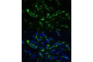 Immunofluorescence analysis of U2OS cells using CGRP antibody (ABIN6128310, ABIN6137852, ABIN6137855 and ABIN6221187) at dilution of 1:100.