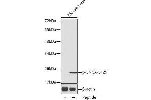 Western blot analysis of extracts from Mouse brain tissue using Phospho-SNCA(S129) Polyclonal Antibody. (SNCA antibody  (pSer129))