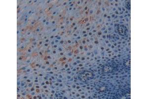IHC-P analysis of esophagus tissue, with DAB staining. (TRERF1 antibody  (AA 779-936))