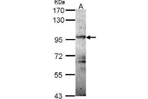 WB Image Sample (30 ug of whole cell lysate) A: Molt-4 , 7. (PKD2 antibody)