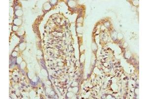 Immunohistochemistry of paraffin-embedded human small intestine tissue using ABIN7155076 at dilution of 1:100