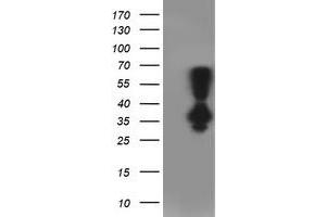 Western Blotting (WB) image for anti-Phenylethanolamine N-Methyltransferase (PNMT) antibody (ABIN1500315) (PNMT antibody)