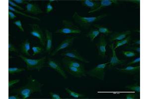 Immunofluorescence of purified MaxPab antibody to NUFIP1 on HeLa cell. (NUFIP1 antibody  (AA 1-276))