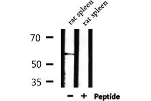 Western blot analysis of extracts from rat brain,mouse brain,rat spleen, using THBD Antibody. (Thrombomodulin antibody  (C-Term))