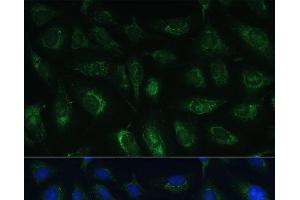 Immunofluorescence analysis of U-2 OS cells using RAPGEF1 Polyclonal Antibody at dilution of 1:100 (40x lens). (GRF2 antibody)