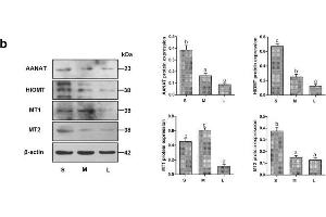 Relative expression of AANAT, HIOMT, MT1, and MT2 in COCs of follicles of different sizes. (AANAT antibody  (AA 141-207))