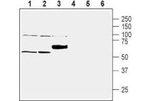 Western blot analysis of mouse lung lysate (lanes 1 and 4), rat liver lysate (lanes 2 and 5) and rat brain membranes (lanes 3 and 6): - 1-3. (SLC30A1 antibody  (C-Term, Intracellular))