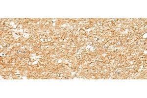 Immunohistochemistry of paraffin-embedded Human brain tissue using ZNF185 Polyclonal Antibody at dilution of 1:25(x200) (Zinc Finger Protein 185 antibody)
