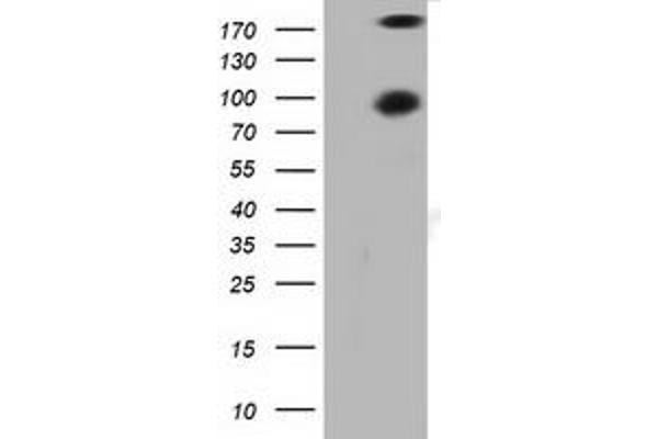 PKD2 antibody