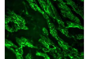 Image no. 1 for anti-Cardiotin antibody (ABIN335362) (Cardiotin antibody)