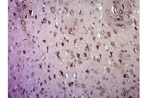 Immunohistochemistry (Paraffin-embedded Sections) (IHC (p)) image for anti-5-Hydroxytryptamine (serotonin) Receptor 2A (HTR2A) (AA 65-160) antibody (ABIN737016)