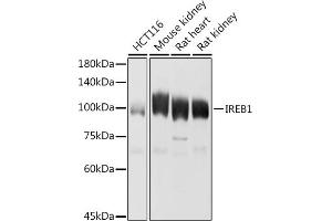 Western blot analysis of extracts of various cell lines, using IREB1 antibody (ABIN6128144, ABIN6136437, ABIN6136439 and ABIN6223846) at 1:1000 dilution. (Aconitase 1 antibody  (AA 1-170))