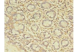 Immunohistochemistry of paraffin-embedded human small intestine tissue using ABIN7174767 at dilution of 1:100 (C19orf47 antibody  (AA 1-281))
