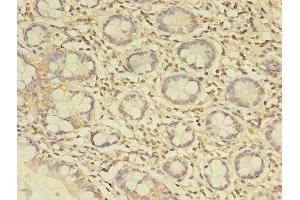 Immunohistochemistry of paraffin-embedded human small intestine tissue using ABIN7174767 at dilution of 1:100