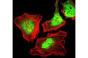 Immunofluorescence (IF) image for anti-Keratin 5 (KRT5) antibody (ABIN969508)