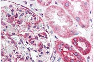 Human Kidney (formalin-fixed, paraffin-embedded) stained with TNFRSF10A antibody ABIN214531 at 5 ug/ml followed by biotinylated goat anti-rabbit IgG secondary antibody ABIN481713, alkaline phosphatase-streptavidin and chromogen. (TNFRSF10A antibody)