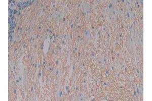 DAB staining on IHC-P; Samples: Human Stomach Tissue (LEFTY1 antibody)