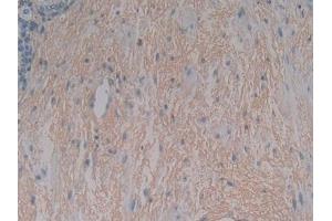 DAB staining on IHC-P; Samples: Human Stomach Tissue (LEFTY1 antibody)