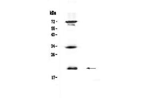 Western blot analysis of IL17B  using anti-IL17B  antibody . (IL17B antibody  (AA 23-180))