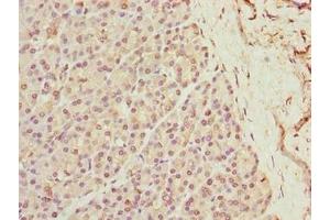 Immunohistochemistry of paraffin-embedded human pancreatic tissue using ABIN7175917 at dilution of 1:100 (xpr1 antibody  (AA 529-696))
