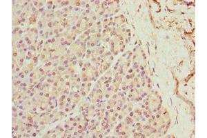 Immunohistochemistry of paraffin-embedded human pancreatic tissue using ABIN7175917 at dilution of 1:100