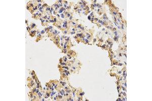 Immunohistochemistry (IHC) image for anti-Microtubule-Associated Protein 1 Light Chain 3 alpha (MAP1LC3A) antibody (ABIN1876819) (MAP1LC3A antibody)