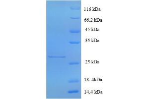 SDS-PAGE (SDS) image for Glutamate Receptor, Ionotropic, AMPA 3 (GRIA3) (AA 151-250), (partial) protein (His-SUMO Tag) (ABIN5709613) (Glutamate Receptor 3 Protein (AA 151-250, partial) (His-SUMO Tag))