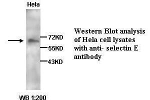 Image no. 1 for anti-Selectin E (SELE) antibody (ABIN790883) (Selectin E/CD62e antibody)