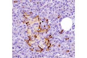 Immunohistochemistry of paraffin embedded human pancreas using Kiaa1324 (ABIN7073822) at dilution of 1:2500 (400x lens) (ELAPOR1 antibody)