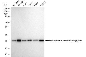 Western blotting analysis using Parkinsonism associated deglycase antibody (ABIN7800048).