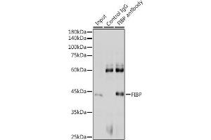 Immunoprecipitation analysis of 300 μg extracts of HeLa cells using 3 μg FIBP antibody . (FIBP antibody  (AA 1-364))
