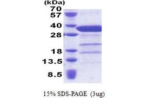SDS-PAGE (SDS) image for Syntaxin 6 (STX6) (AA 1-234) protein (His tag) (ABIN5853260) (Syntaxin 6 Protein (STX6) (AA 1-234) (His tag))