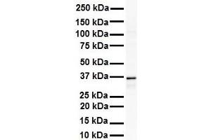 WB Suggested Anti-GAPDH antibody Titration: 1 ug/mL Sample Type: Human Raji (GAPDH antibody  (Middle Region))