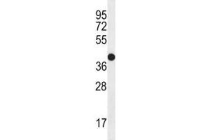 Western Blotting (WB) image for anti-Nerve Growth Factor Receptor (NGFR) (AA 353-380) antibody (ABIN3031958)