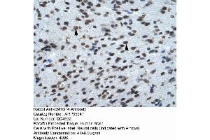 Rabbit Anti-Q9HB14 Antibody  Paraffin Embedded Tissue: Human Brain Cellular Data: Neural Cells Antibody Concentration: 4. (KCNK13 antibody  (C-Term))