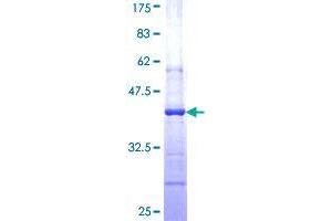 AGO1 Protein (AA 101-200) (GST tag)
