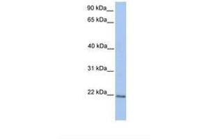 ZNF548 antibody  (C-Term)