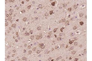 Paraformaldehyde-fixed, paraffin embedded mouse brain, Antigen retrieval by boiling in sodium citrate buffer (pH6) for 15min, Block endogenous peroxidase by 3% hydrogen peroxide for 30 minutes, Blocking buffer (normal goat serum) at 37°C for 20min, Antibody incubation with TMP21 Polyclonal Antibody, Unconjugated  at 1:200 overnight at 4°C, followed by a conjugated secondary and DAB staining. (TMED10 antibody  (AA 101-200))