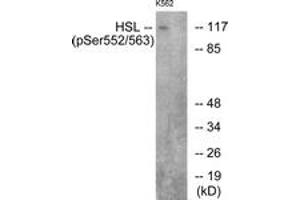 Western blot analysis of extracts from K562 cells, using HSL (Phospho-Ser552) Antibody. (LIPE antibody  (pSer552))