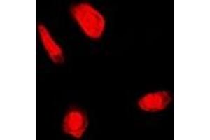 Immunofluorescent analysis of FANCC staining in U2OS cells. (FANCC antibody)