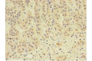 Immunohistochemistry of paraffin-embedded human adrenal gland tissue using ABIN7145562 at dilution of 1:100 (EPHX2 antibody  (AA 1-555))